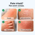 Puradoro Cremă Anti-Dermatită & Eczeme – Naturală, Calmează Iritațiile, Reduce Roșeața și Elimină Cojile 50ml - imagine 3